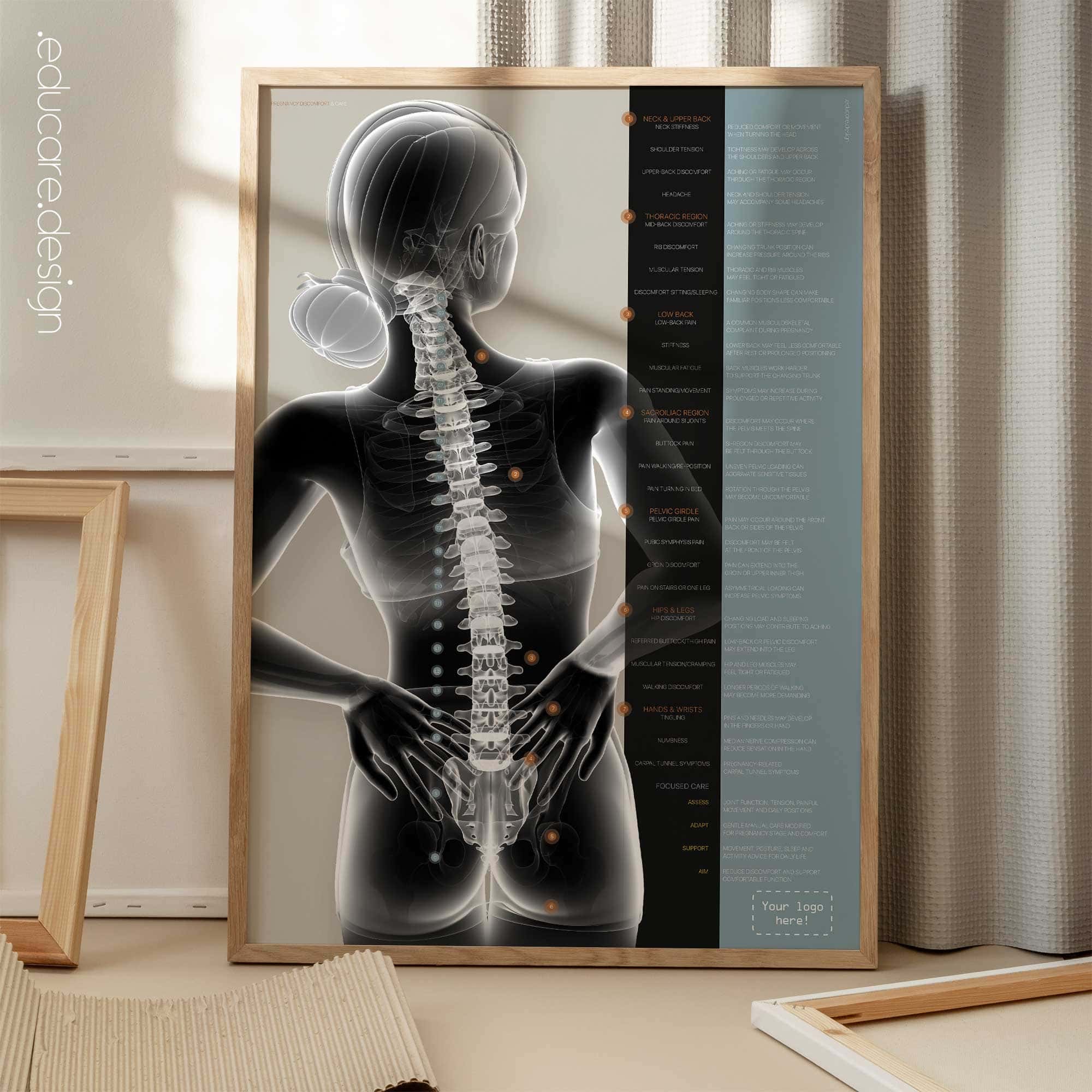 Pregnancy Discomfort and Care anatomy chart for clinics
