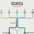 Sciatica Clinical Testing Reference anatomy chart for clinics