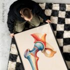 Chromatic Hip anatomy chart for clinics